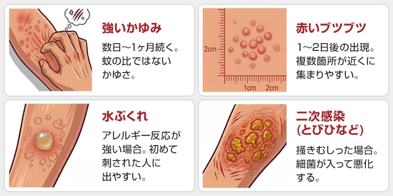ノミに刺されると人間はどうなる？猛烈なかゆみの症状・跡の見分け方・対処法